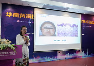 廣州美萊首推簽約祛斑責(zé)任制 助祛斑失敗毀容女士修復(fù)治療